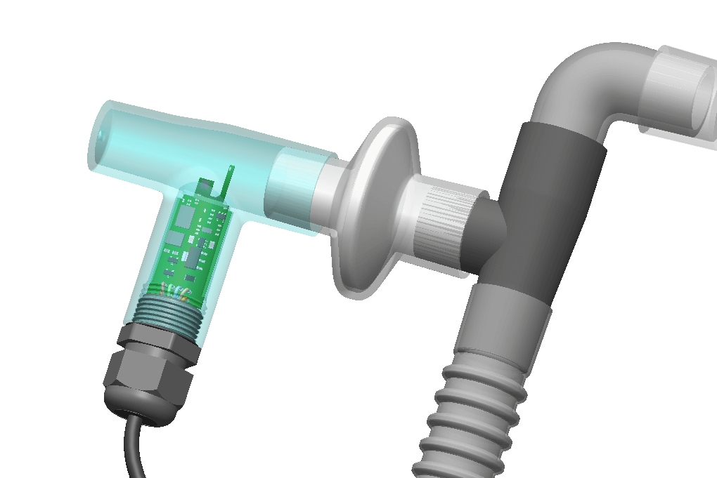 ventilator case study